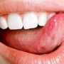 LAVORIAMO SULLA VOCE + Completed